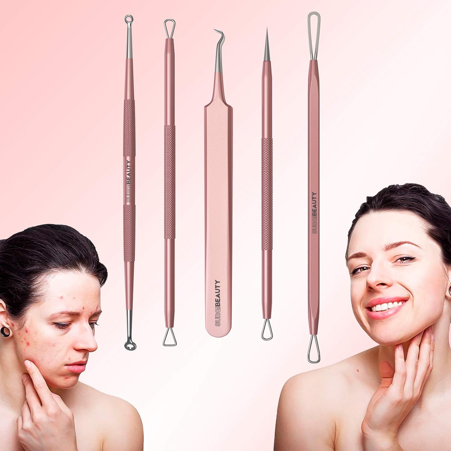 SURGIBEAUTY Blackhead Removal/Pimple Popper Tool Kit